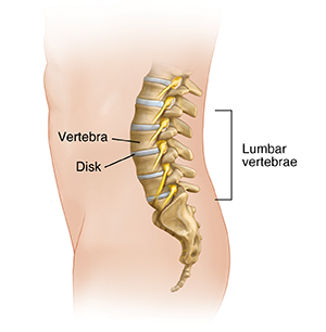 Side view of male figure showing lumbar spine anatomy.